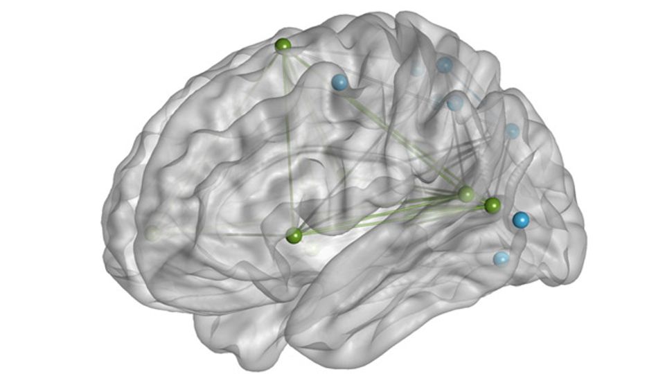 Adults With PTSD Have Lower Brain Connectivity content piece image