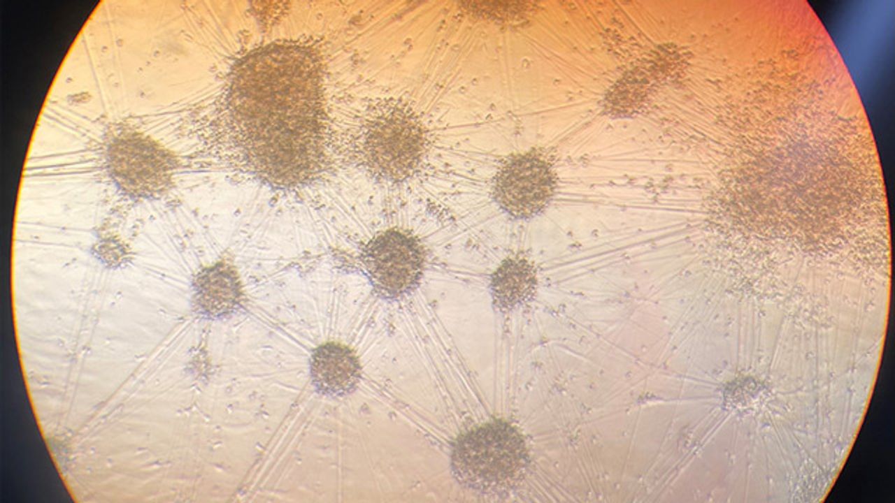 RNA Targeting Could Provide Treatment for ALS