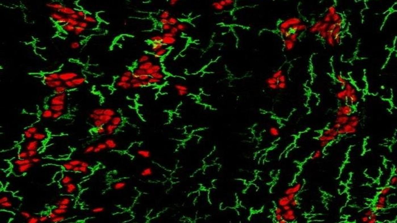 Foodborne Diseases May Actually Protect the Gut's Nervous System