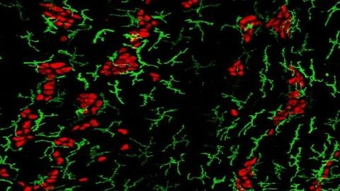 Foodborne Diseases May Actually Protect the Gut's Nervous System