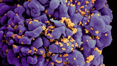 How Did Two People Control Their HIV After Ceasing Treatment?