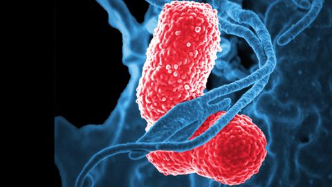 Inflammatory Mediator Could Be Targeted To Treat Pneumonia
