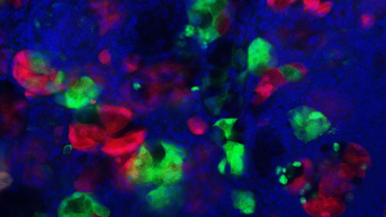 Mechanism To Mitigate Pancreatic Injury Impacts Cancer Formation