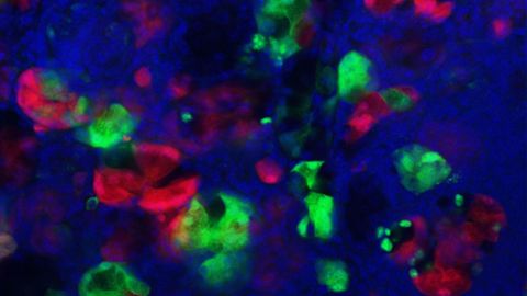 Mechanism To Mitigate Pancreatic Injury Impacts Cancer Formation
