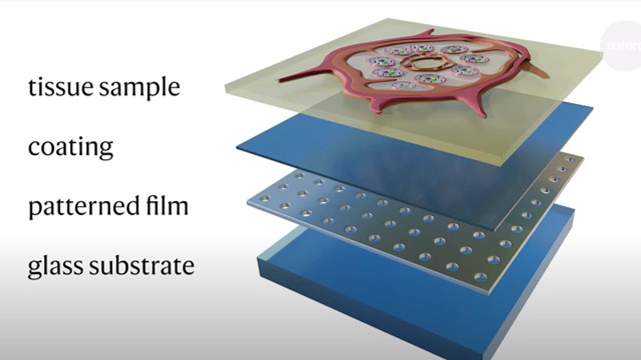 Cancer in Nanocolor: A New Type of Microscope Slide