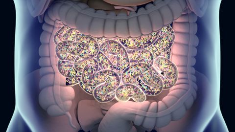 Five Challenges Limiting Widespread Adoption of Microbiome-Based Diagnostics