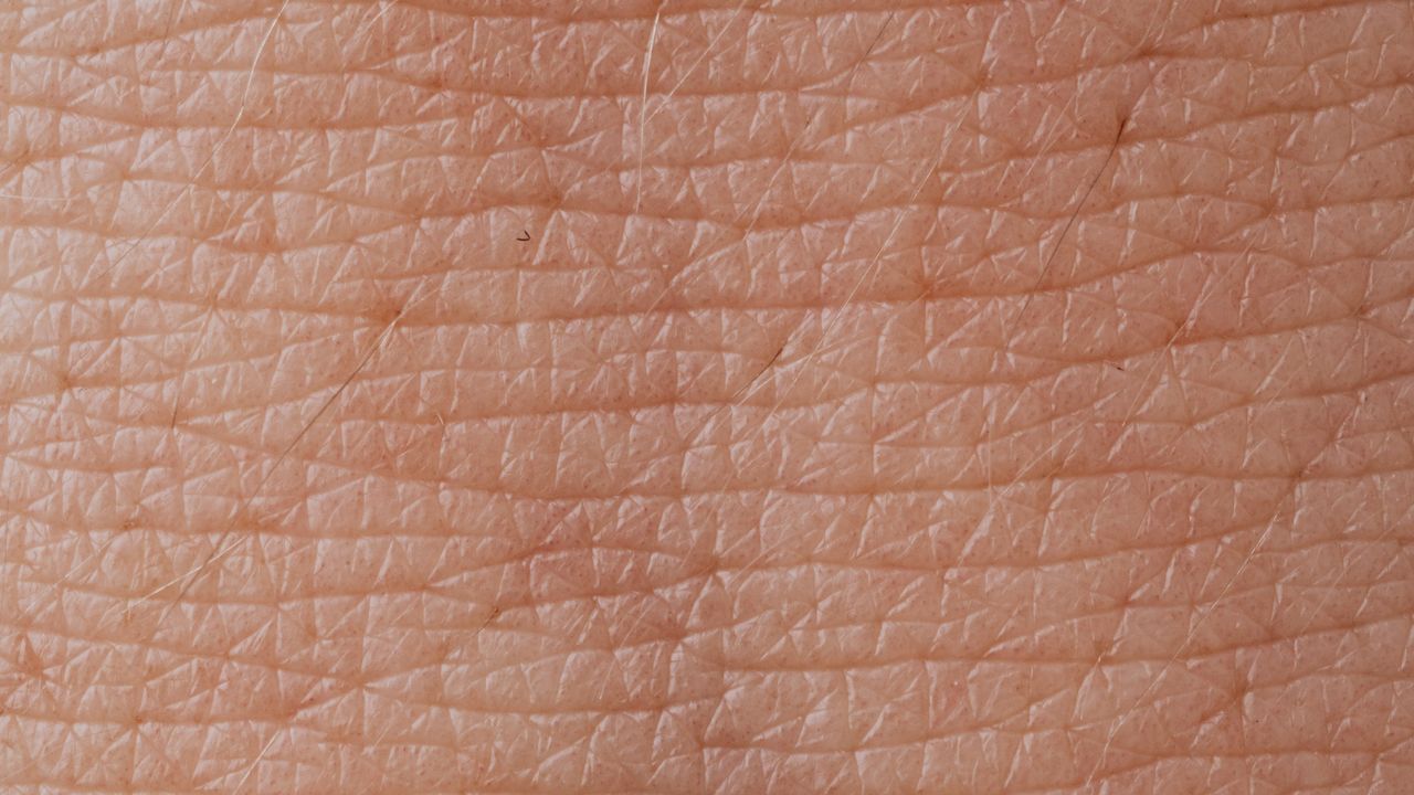 Newly Discovered Skin Cell May Underlie Inflammatory Skin Disease