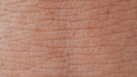 Newly Discovered Skin Cell May Underlie Inflammatory Skin Disease