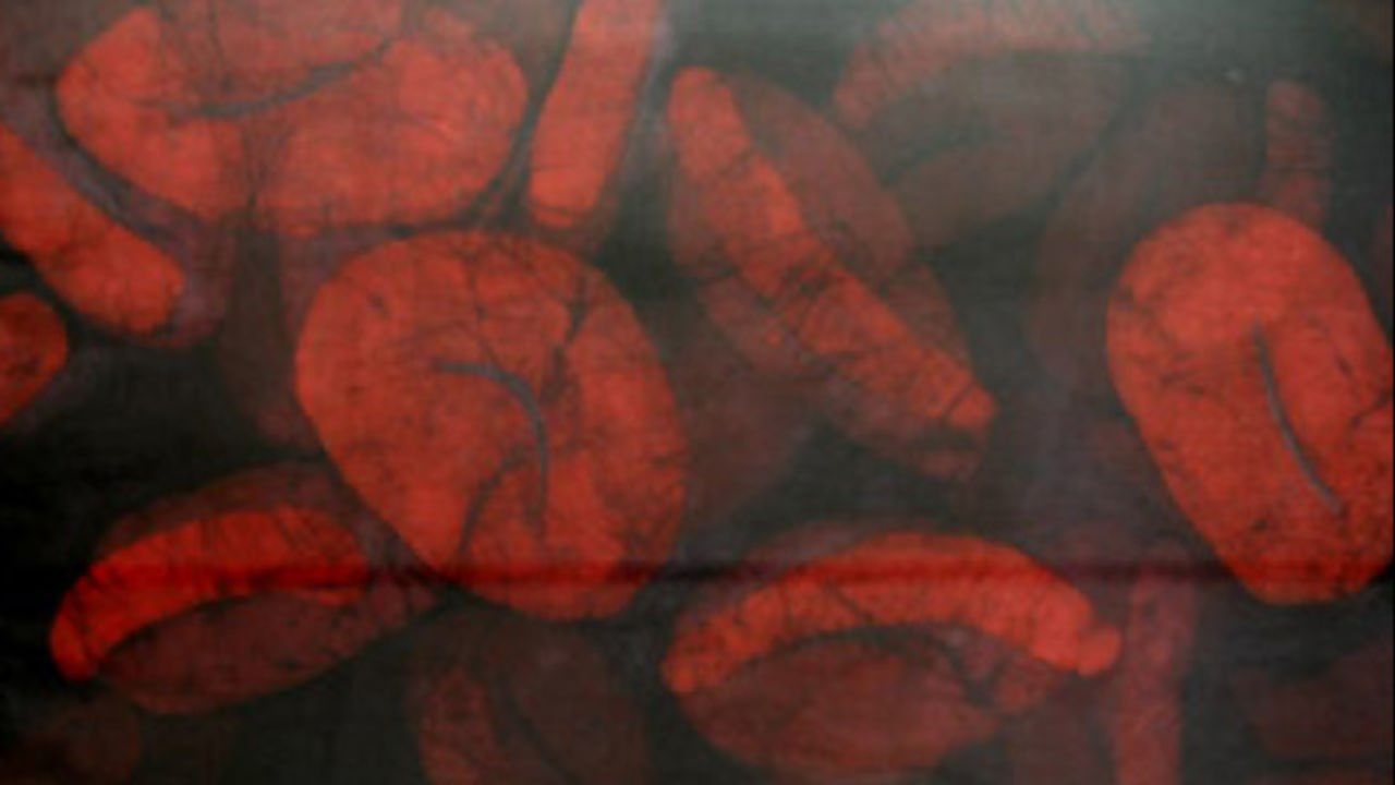 Unexpected Antibody Type Found in Malaria-Infected Individuals