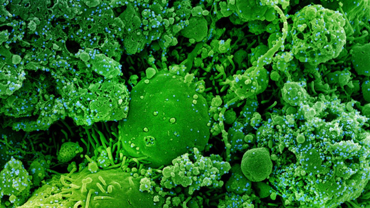 Cells Infected With a Variant Strain of SARS-CoV-2