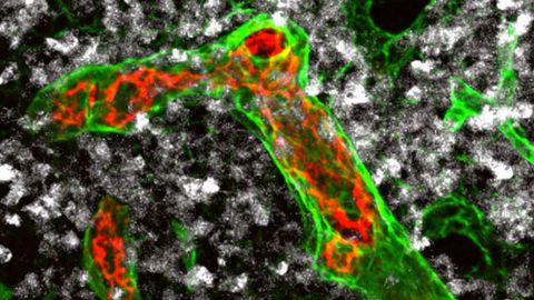 Lymphomas Remodel Blood Vessels To Evade Detection