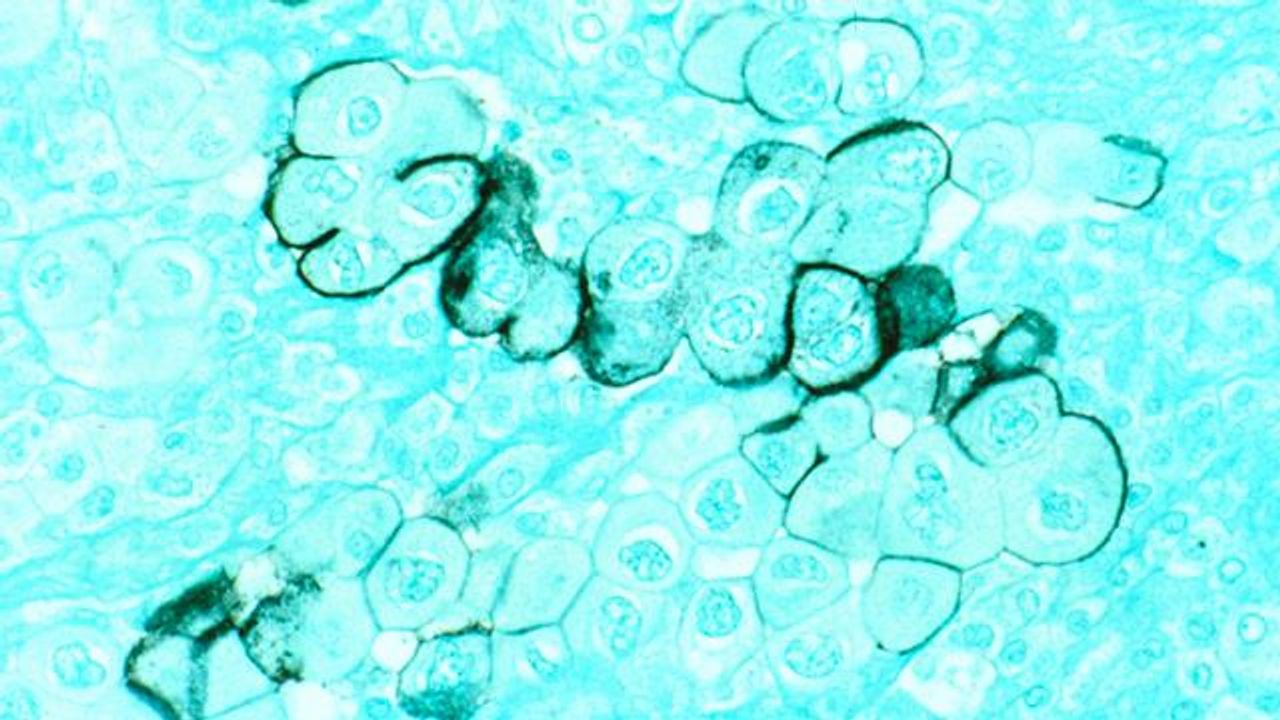Experimental Drug Enhances Immunotherapy in Mouse Model of Pancreatic Cancer