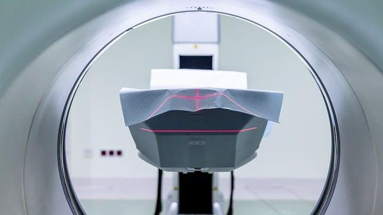 Lower Lifetime Estrogen Exposure Linked to Gray Matter Loss