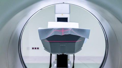Lower Lifetime Estrogen Exposure Linked to Gray Matter Loss