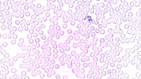 Protecting Macrophages From Overload Helps Inflammation Resolution