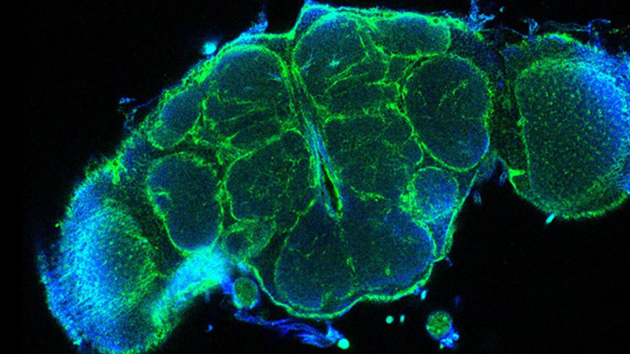 A New Barrier in the Brain Is Detected