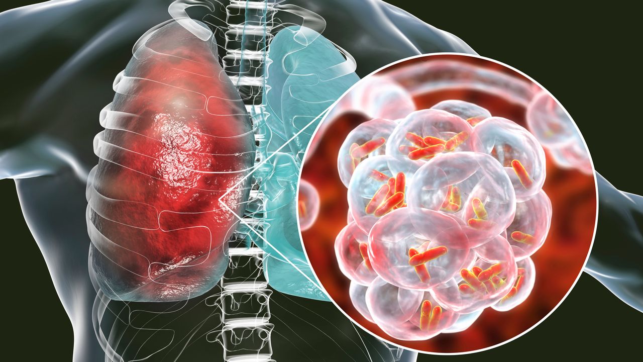 Progress Towards a Mucosal Vaccine for Pneumonia