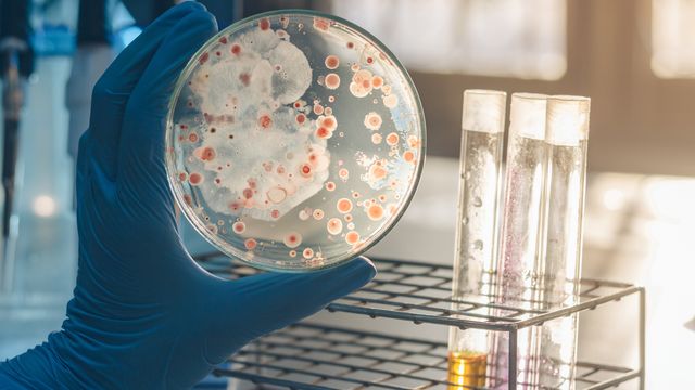 A gloved hand holds up a petri dish, on which bacterial colonies are growing. 