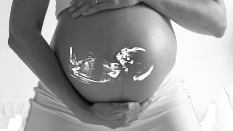 Selecting the Best Placental Model