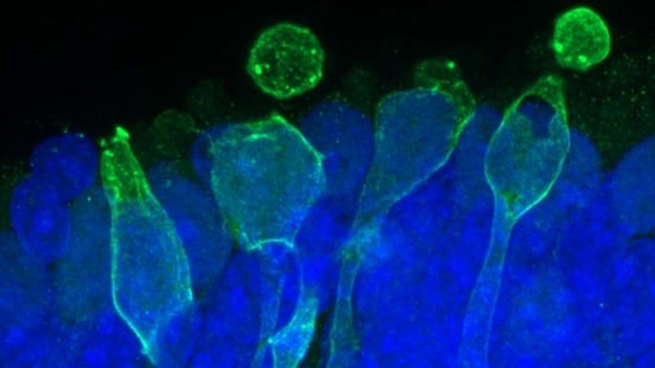 Generating Cell Repellent Surfaces in Microfluidic Devices