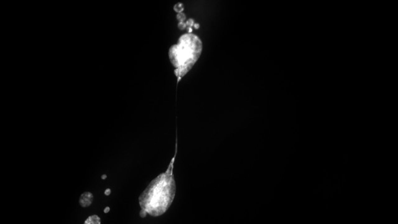 Cellular Senescence Is Caused by Irreversible Damage to the Genome