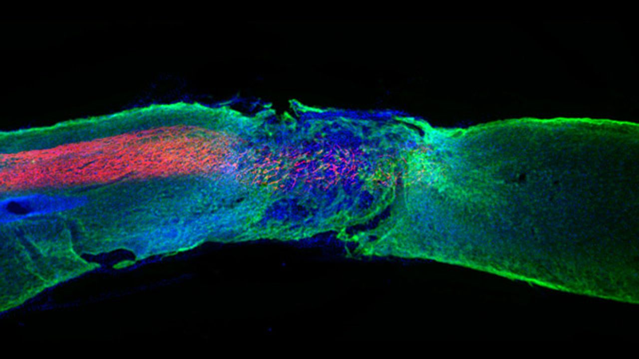 Injectable Therapy Reverses Paralysis in Mice