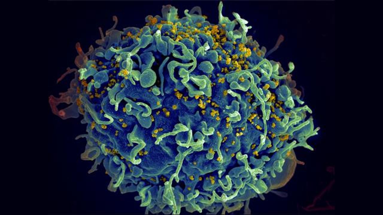 Sugar Molecule on HIV-Infected Cell Helps Immune Evasion