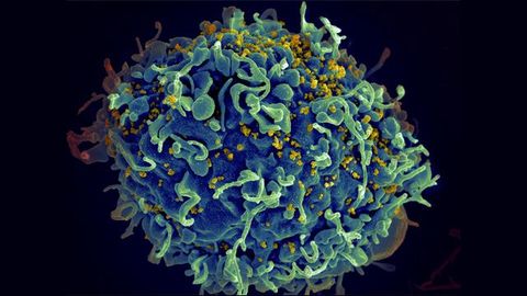 Sugar Molecule on HIV-Infected Cell Helps Immune Evasion