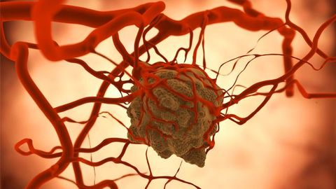 Synthetic Immunotherapy Destroys Tumors in Mice
