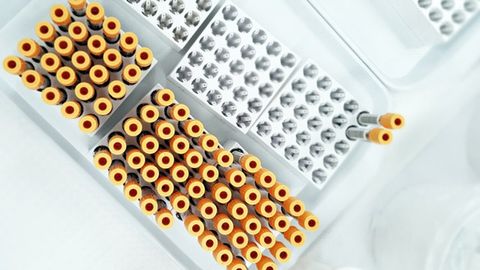 Noninvasive Brain Biopsy Shows Improved Sensitivity in Tumor Detection