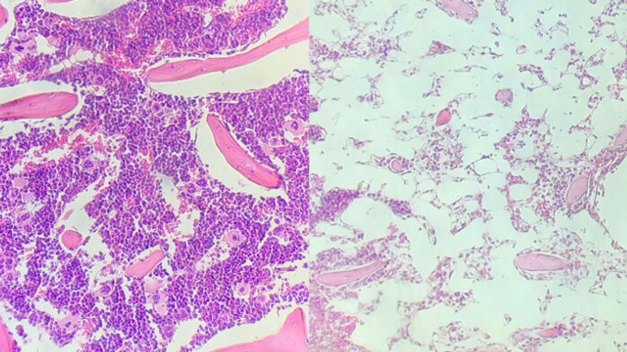 New Technique May Lead to Safer Stem Cell Transplants
