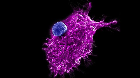 Towards an “Off-the-Shelf” Immunotherapy for Cancer