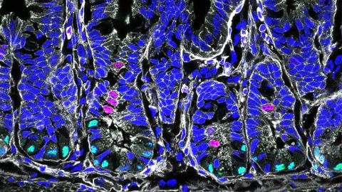 New Link Between Diet, Intestinal Stem Cells and Disease Discovered
