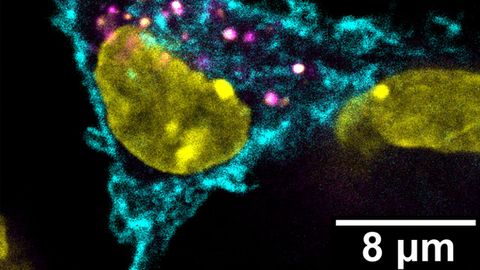 Stimulating T Cells To Attack Tumors