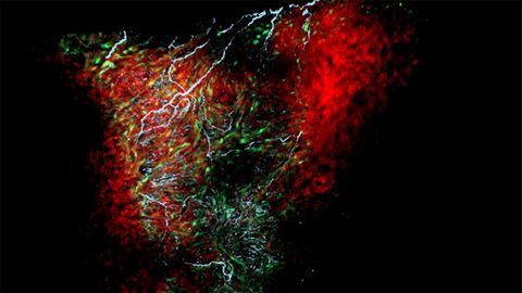 New Type of Cell Discovered in the Heart