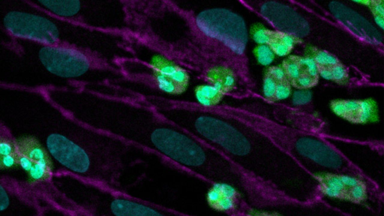 Cystic Fibrosis Modeled Using New Microfluidic Organ-on-a-Chip