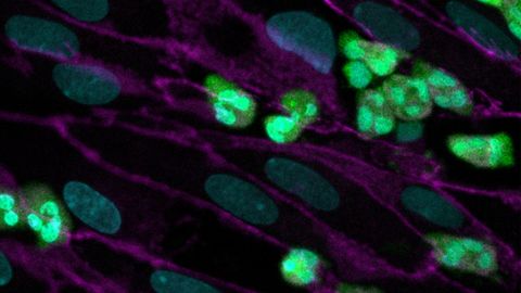 Cystic Fibrosis Modeled Using New Microfluidic Organ-on-a-Chip