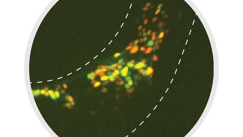 Brain Circuit Helps Worms Decide Whether To Feast or Forage