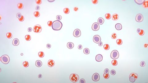 What Is Myeloma?