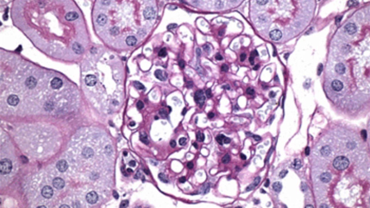 Experimental Compound Reduced Complications of Diabetes in Mice