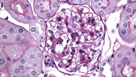 Experimental Compound Reduced Complications of Diabetes in Mice