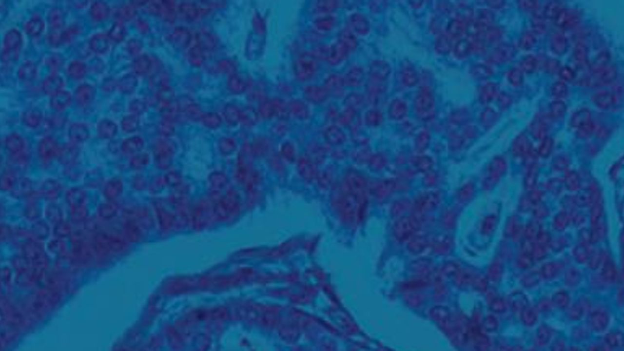 Whole Exome Sequencing