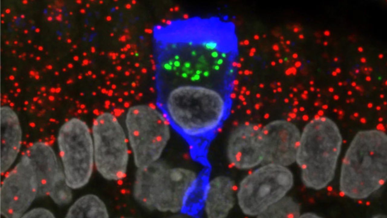 SARS-CoV-2 Does Not Appear To Infect Olfactory Sensory Neurons