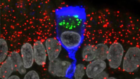 SARS-CoV-2 Does Not Appear To Infect Olfactory Sensory Neurons
