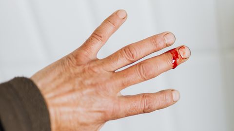 Stem Cell Memories May Drive Wound Repair