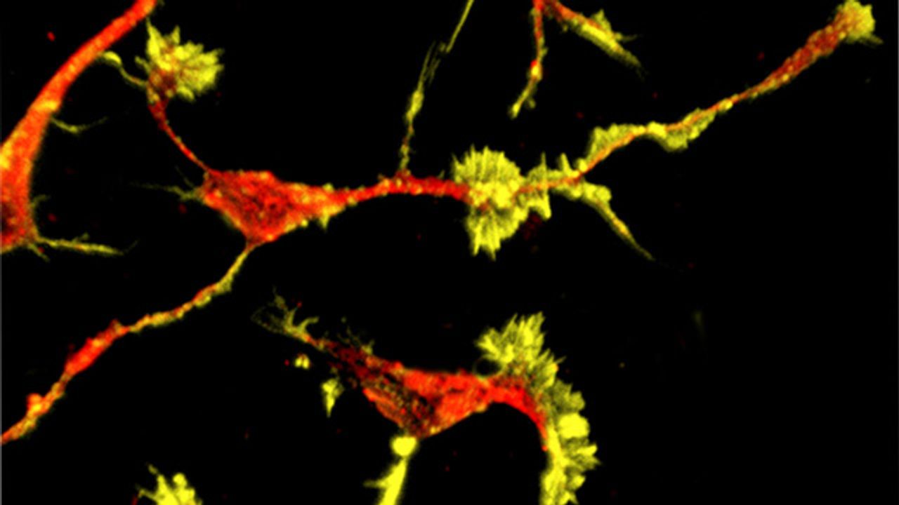 Downstream Effects of High-Risk Autism Gene Uncovered