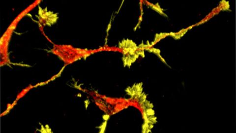 Downstream Effects of High-Risk Autism Gene Uncovered
