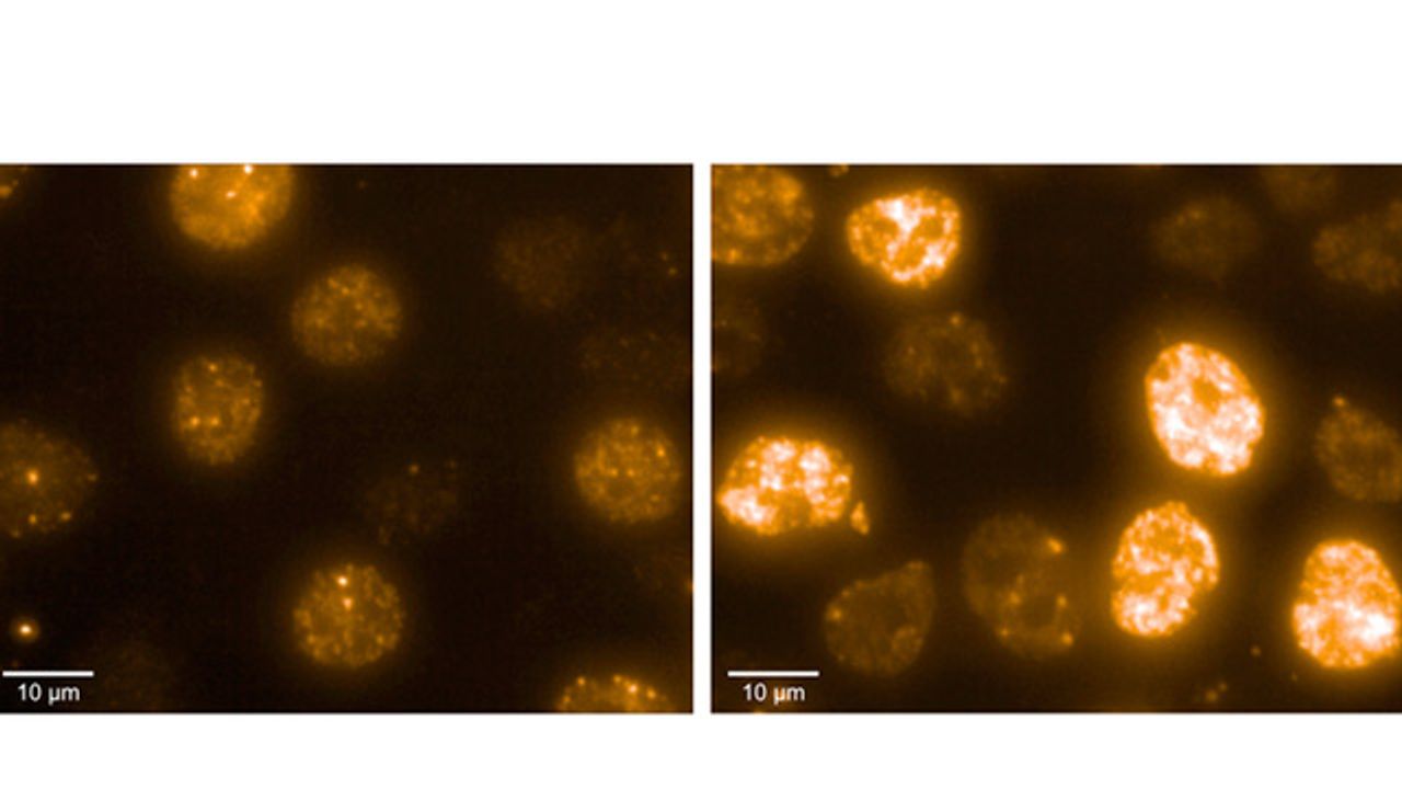 How Neuroblastoma Cells Deal With the Dangers of Rapid Cell Division