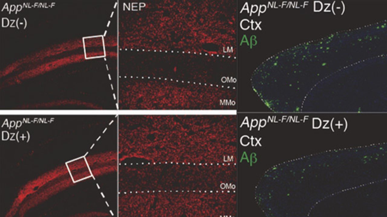 Alzheimer's Drug Tested in Mice Could Have Benefits Over Existing Treatments