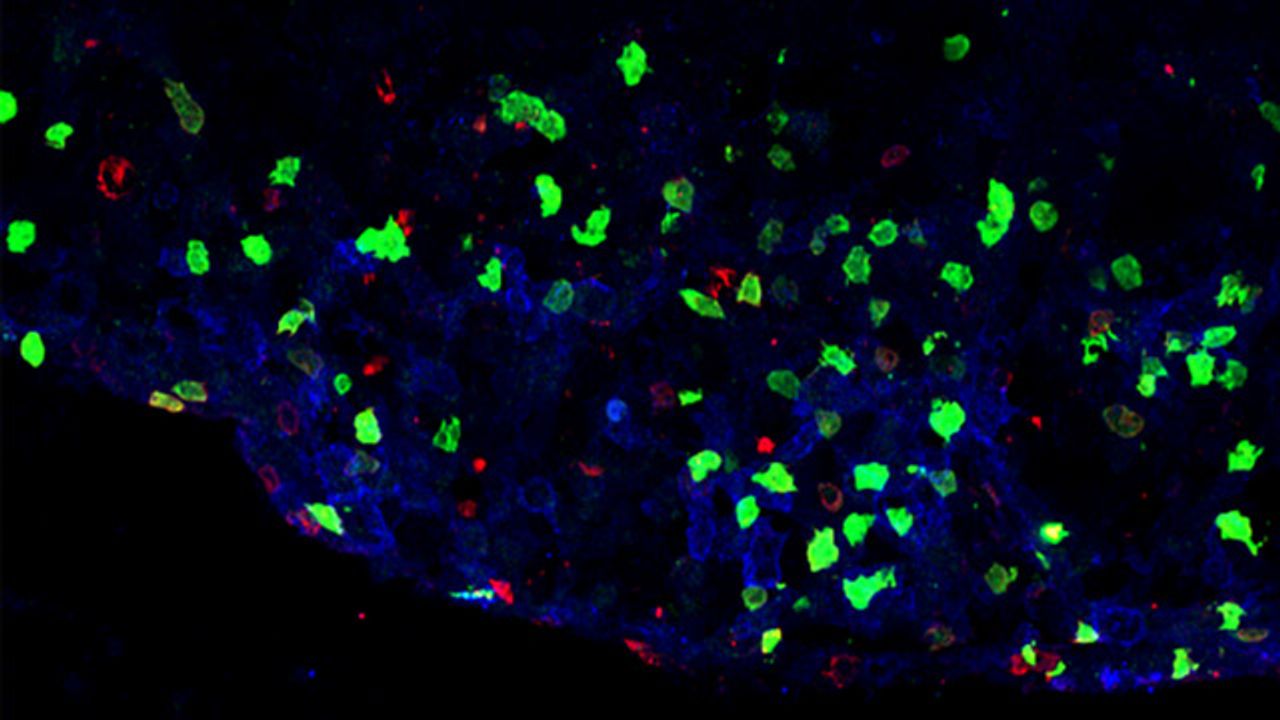 Newly Identified Cell Subset May Help Trigger Multiple Sclerosis-Like Inflammation